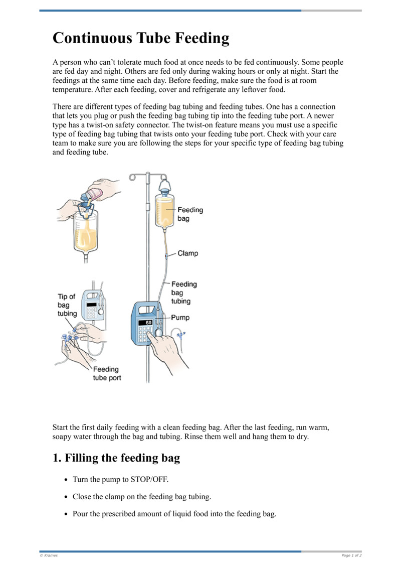 Text Continuous Tube Feeding HealthClips Online