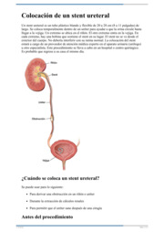 Thumbnail image for "Colocación de un catéter ureteral"