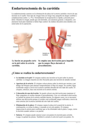 Thumbnail image for "Endarterectomía de la carótida"