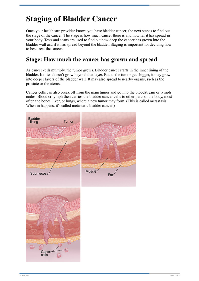 What Are The Grades Of Bladder Cancer