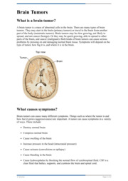 Thumbnail image for "Brain Tumors"
