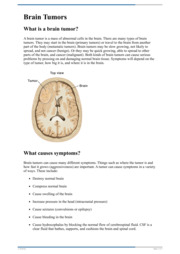 Thumbnail image for "Brain Tumors"
