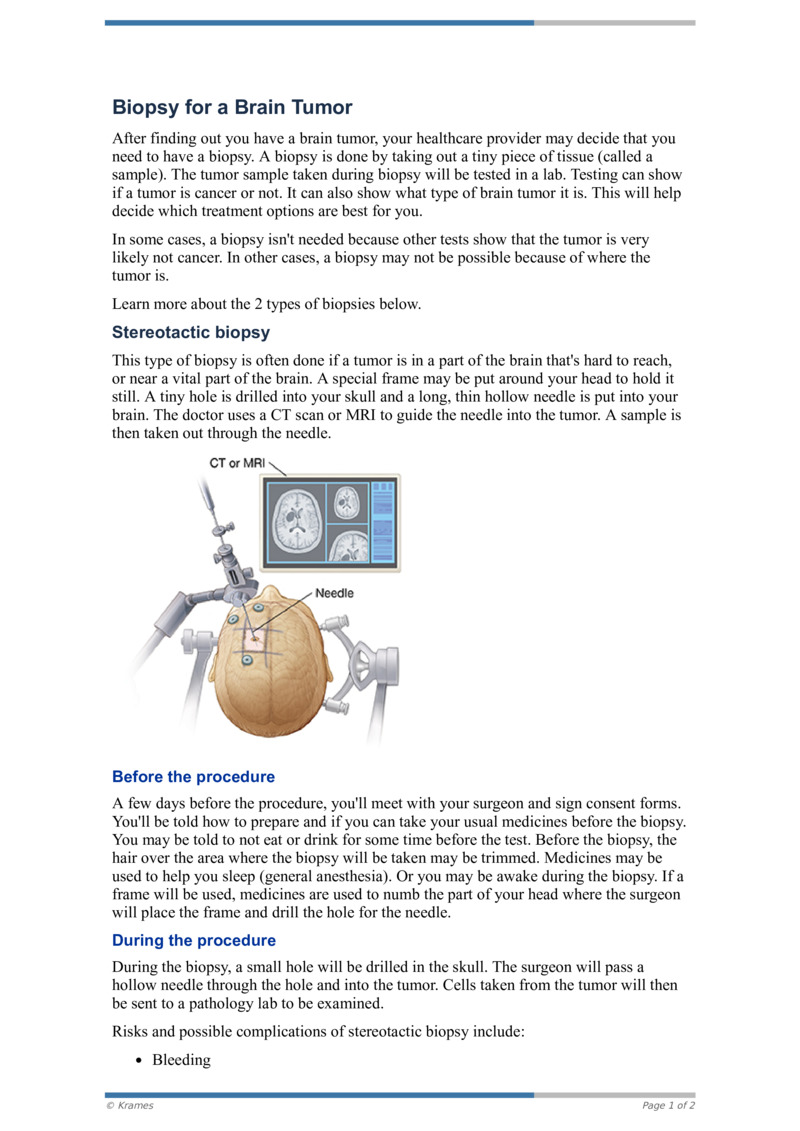 pdf-biopsy-for-a-brain-tumor-healthclips-online