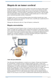 Thumbnail image for "Biopsia de un tumor cerebral"