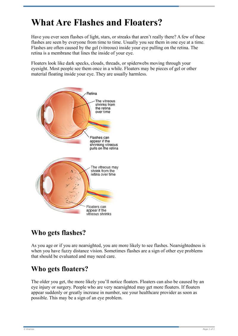 Text What Are Flashes and Floaters? HealthClips Online