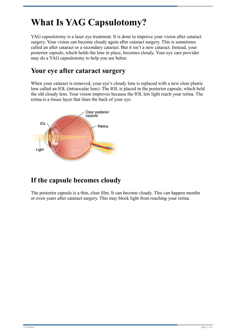 Text What Is YAG Capsulotomy? HealthClips Online