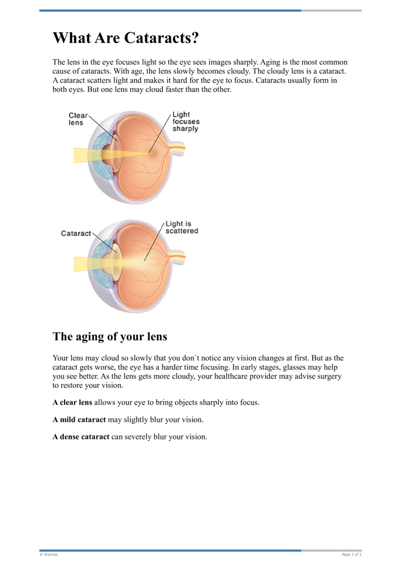 Text - What Are Cataracts? - HealthClips Online
