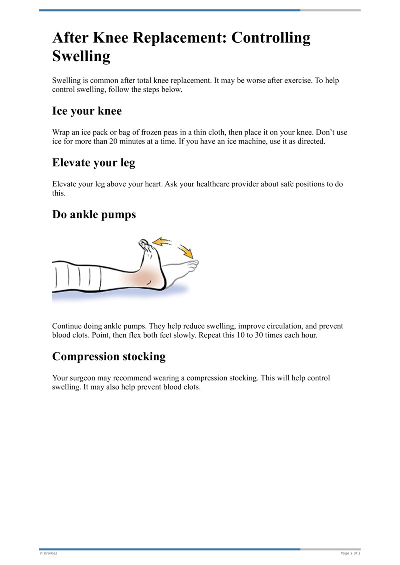 Text After Knee Replacement Controlling Swelling HealthClips Online