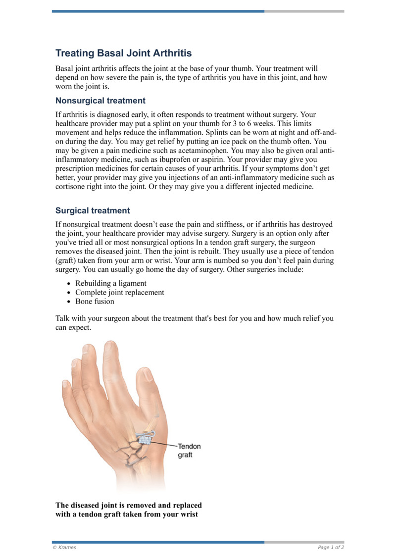 PDF Treating Basal Joint Arthritis HealthClips Online