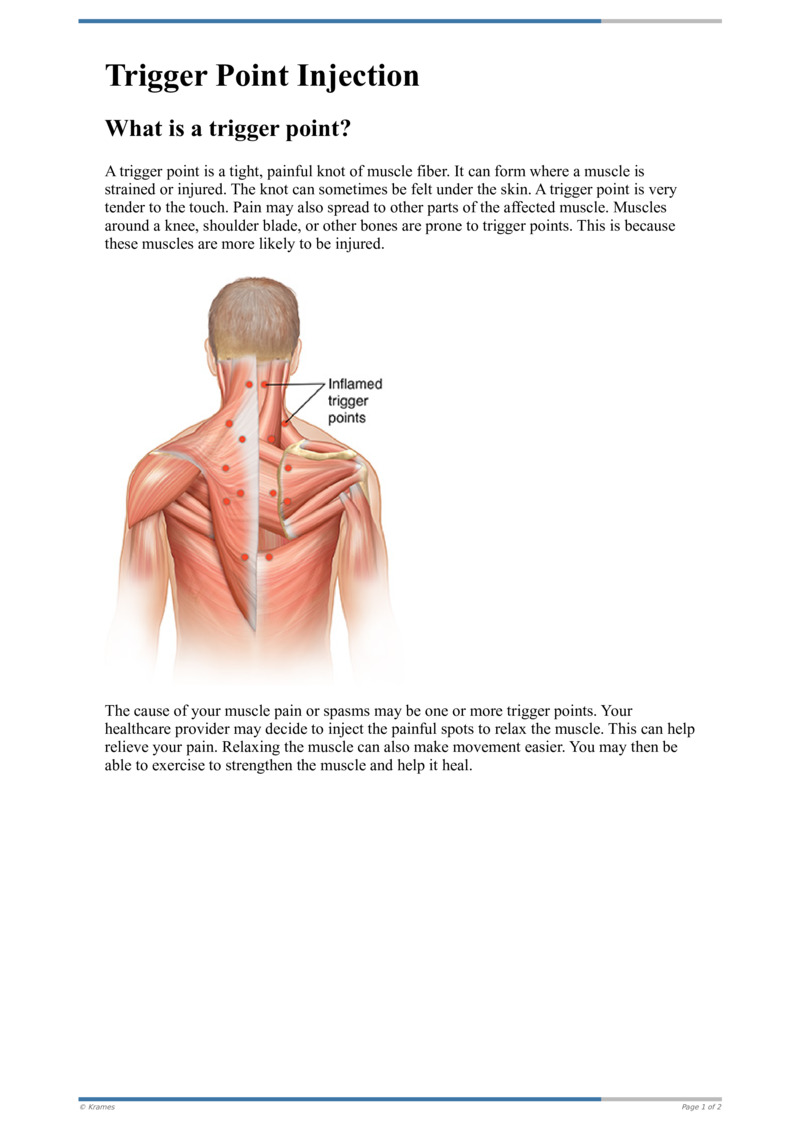 Painful Knotted Muscles? Trigger Point Injections Might Help