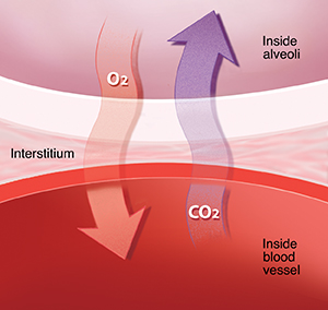 Interstitial Text - Interstitial Lung Disease - HealthClips Online