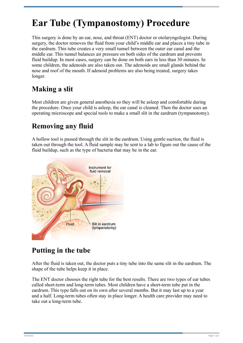 Text Tympanostomy Ear Tube Procedure HealthClips Online text-tympanostomy-ear-tube-procedure-healthclips-online