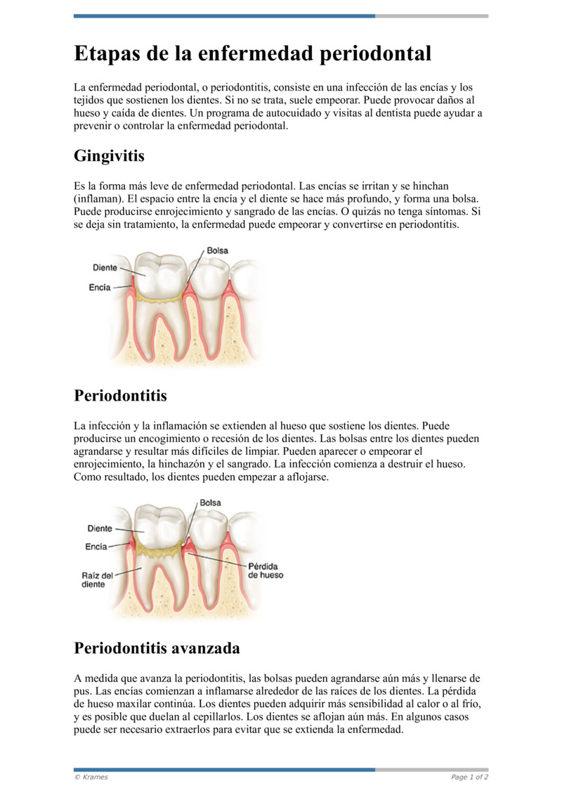 PDF Etapas De La Enfermedad Periodontal HealthClips Online