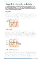 Thumbnail image for "Etapas de la enfermedad periodontal"