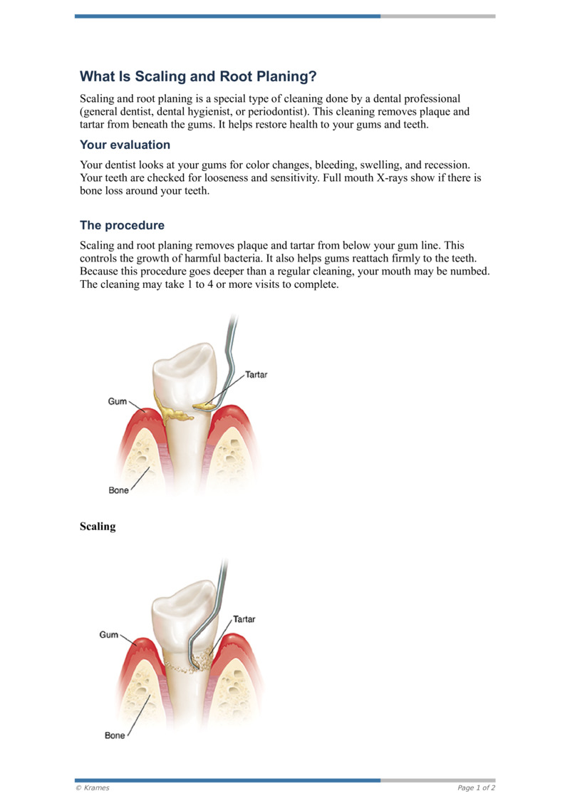 Text What Is Scaling and Root Planing? HealthClips Online