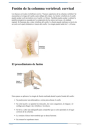 Thumbnail image for "Fusión de la columna vertebral: cervical"