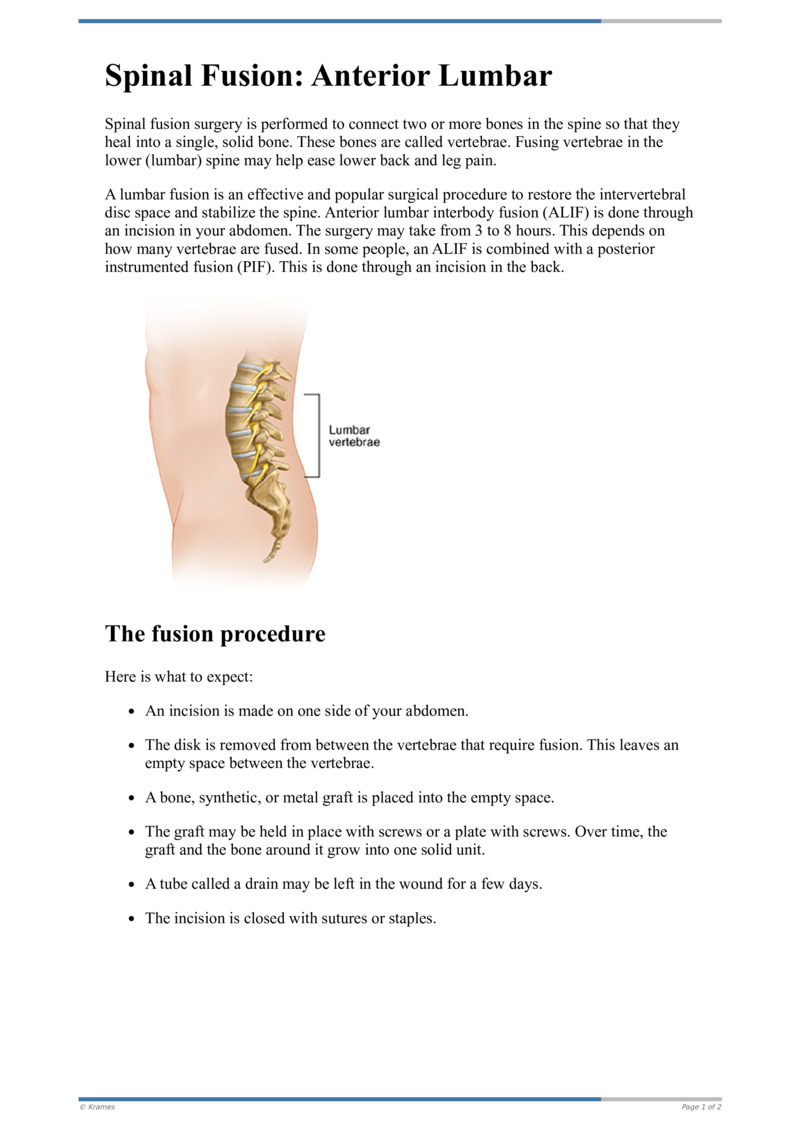 Text Spinal Fusion Anterior Lumbar Healthclips Online