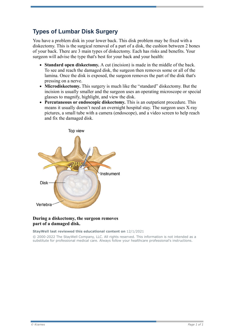 PDF Types of Lumbar Disk Surgery HealthClips Online