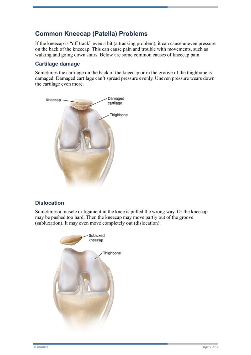 Pdf Common Kneecap Patella Problems Healthclips Online