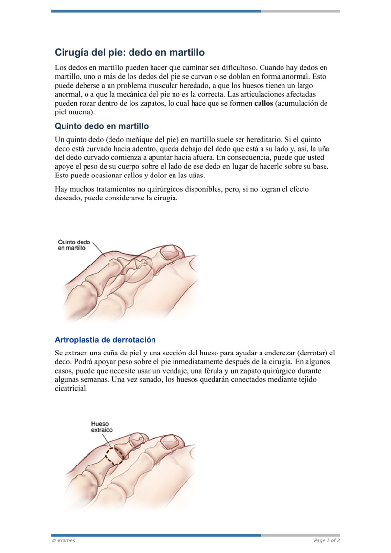 PDF Cirugía del pie dedo en martillo HealthClips Online