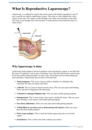 Thumbnail image for "What Is Reproductive Laparoscopy?"