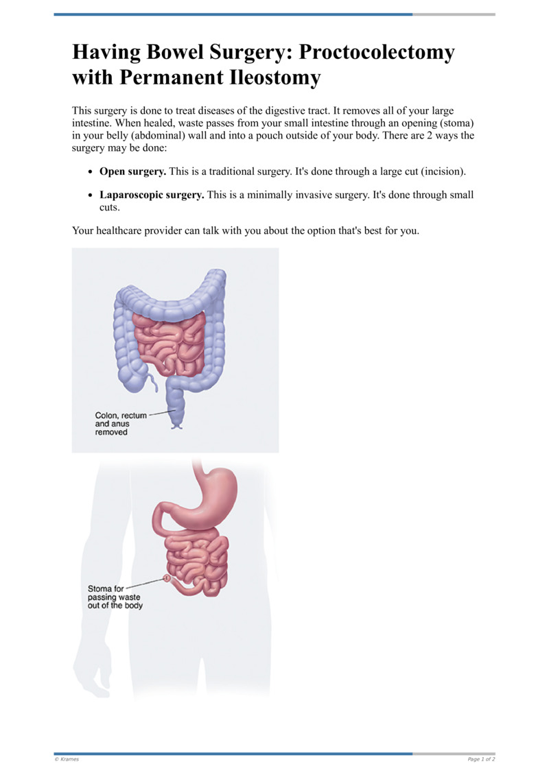 text-having-bowel-surgery-proctocolectomy-with-permanent-ileostomy