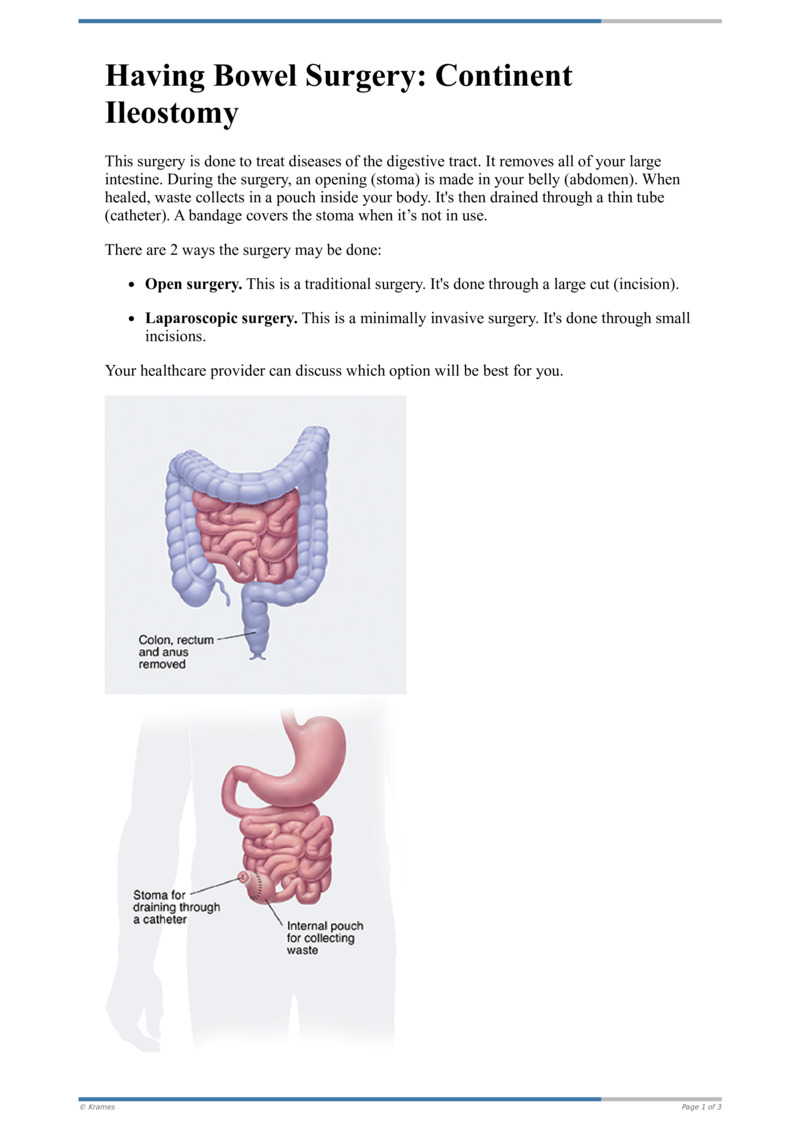Text Having Bowel Surgery Continent Ileostomy HealthClips Online