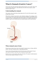 Thumbnail image for "What Is Stomach (Gastric) Cancer?"