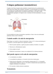 Thumbnail image for "Colapso pulmonar (neumotórax)"