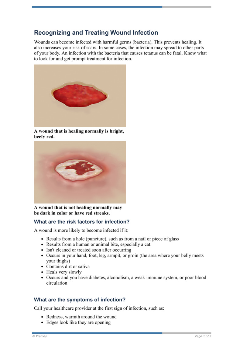 Stages Of Wound Infection