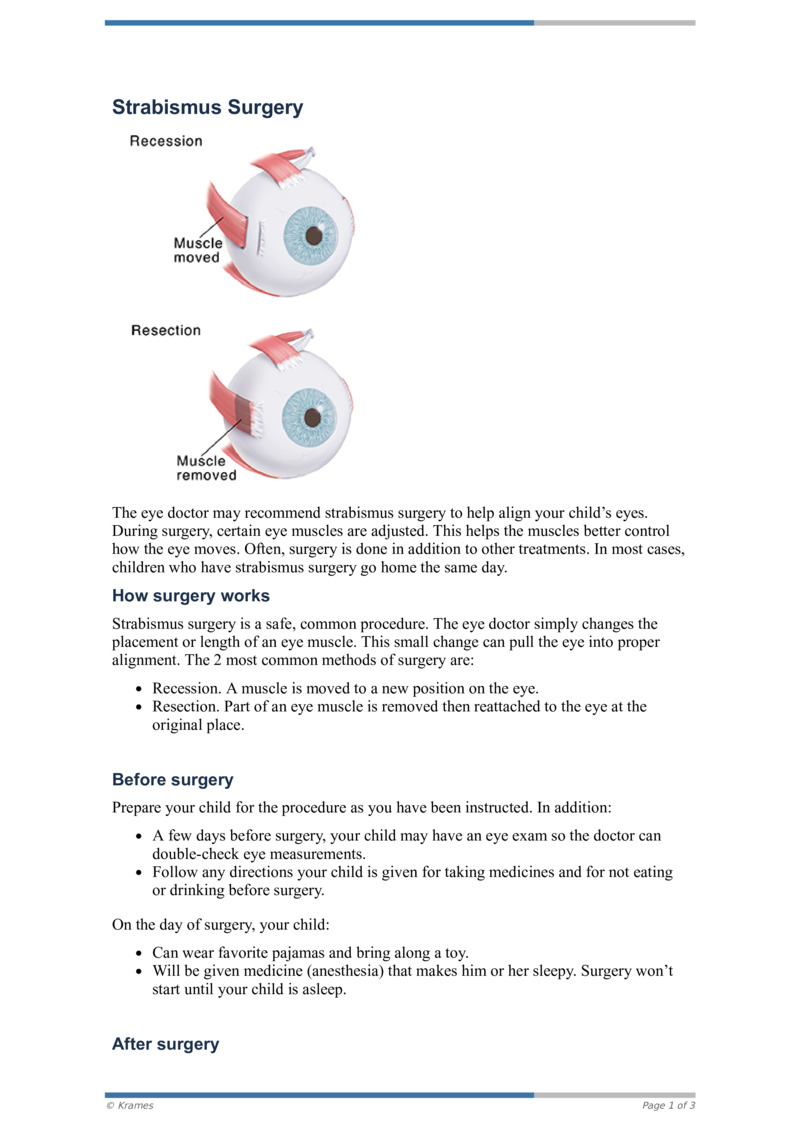 Pdf Strabismus Surgery Healthclips Online