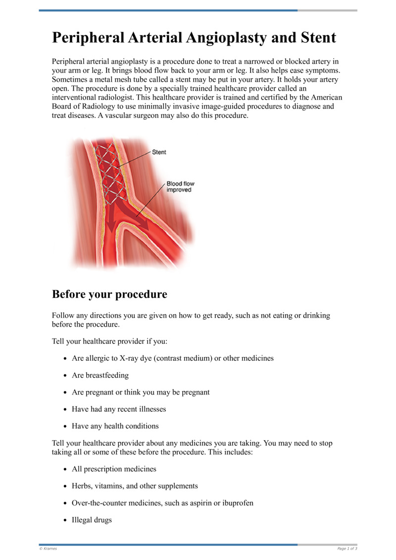 Text - Peripheral Arterial Angioplasty and Stent - HealthClips Online