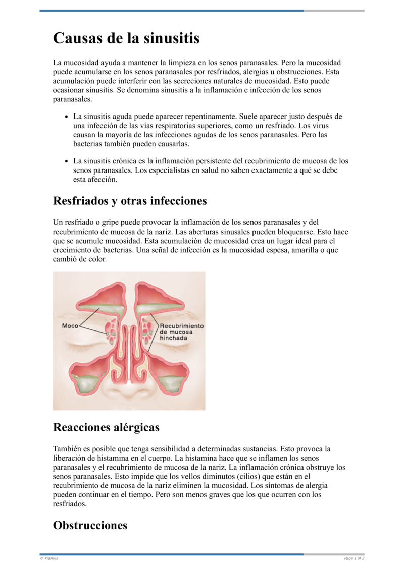 Poster image for "Causas de la sinusitis"