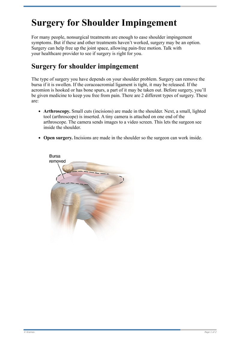 Text - Surgery for Shoulder Impingement - HealthClips Online