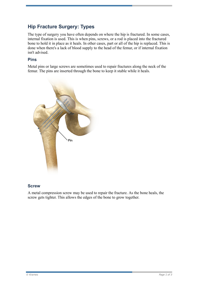 PDF Hip Fracture Surgery Types HealthClips Online