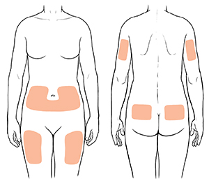 Text - Giving a Subcutaneous (Sub-Q) Injection (Single Medicine)