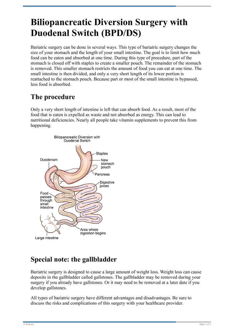 Poster image for "Biliopancreatic Diversion Surgery with Duodenal Switch (BPD/DS)"