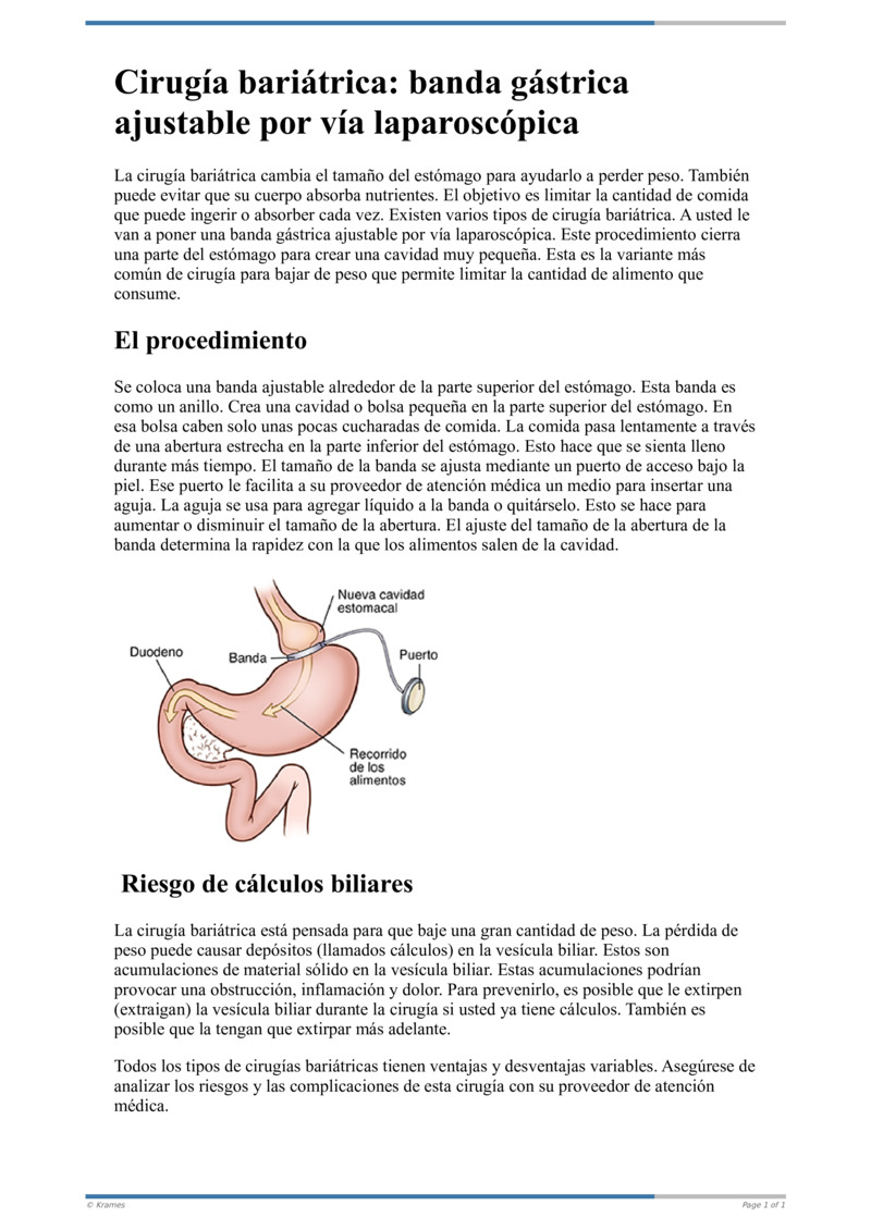 Poster image for "Cirugía bariátrica: banda gástrica ajustable por vía laparoscópica"