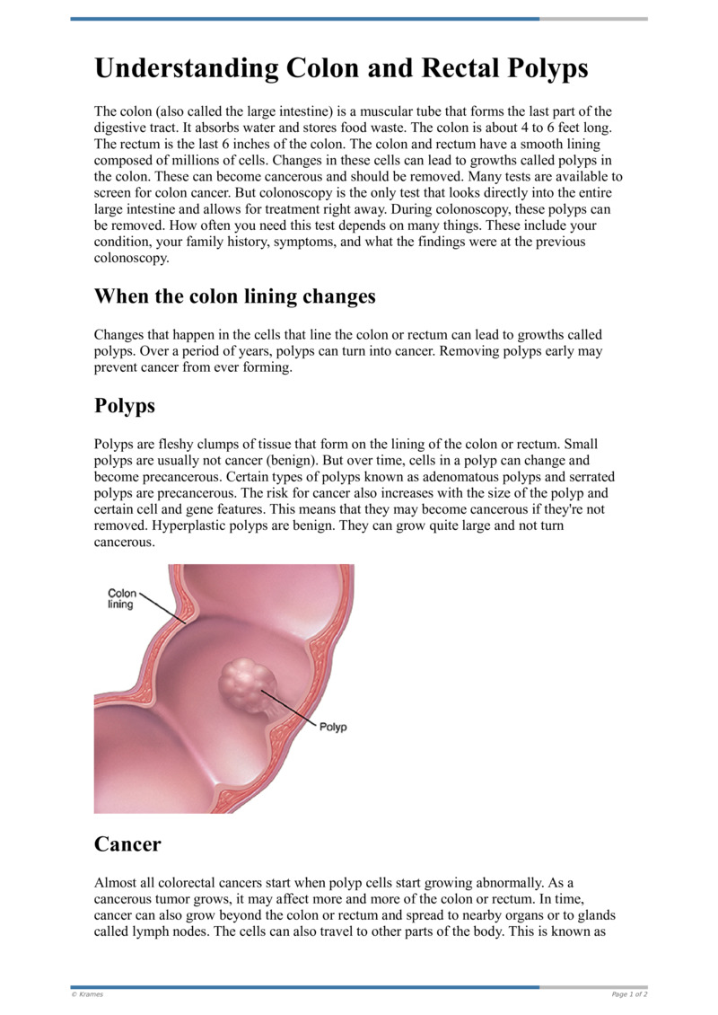 Poster image for "Understanding Colon and Rectal Polyps"