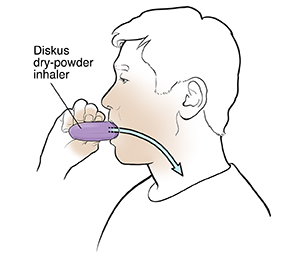 Text - COPD: Using Inhalers - HealthClips Online