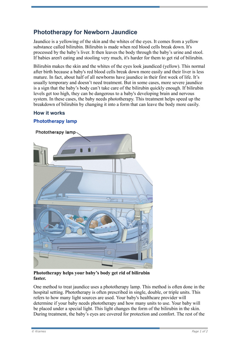 PDF  Phototherapy for Newborn Jaundice  HealthClips Online