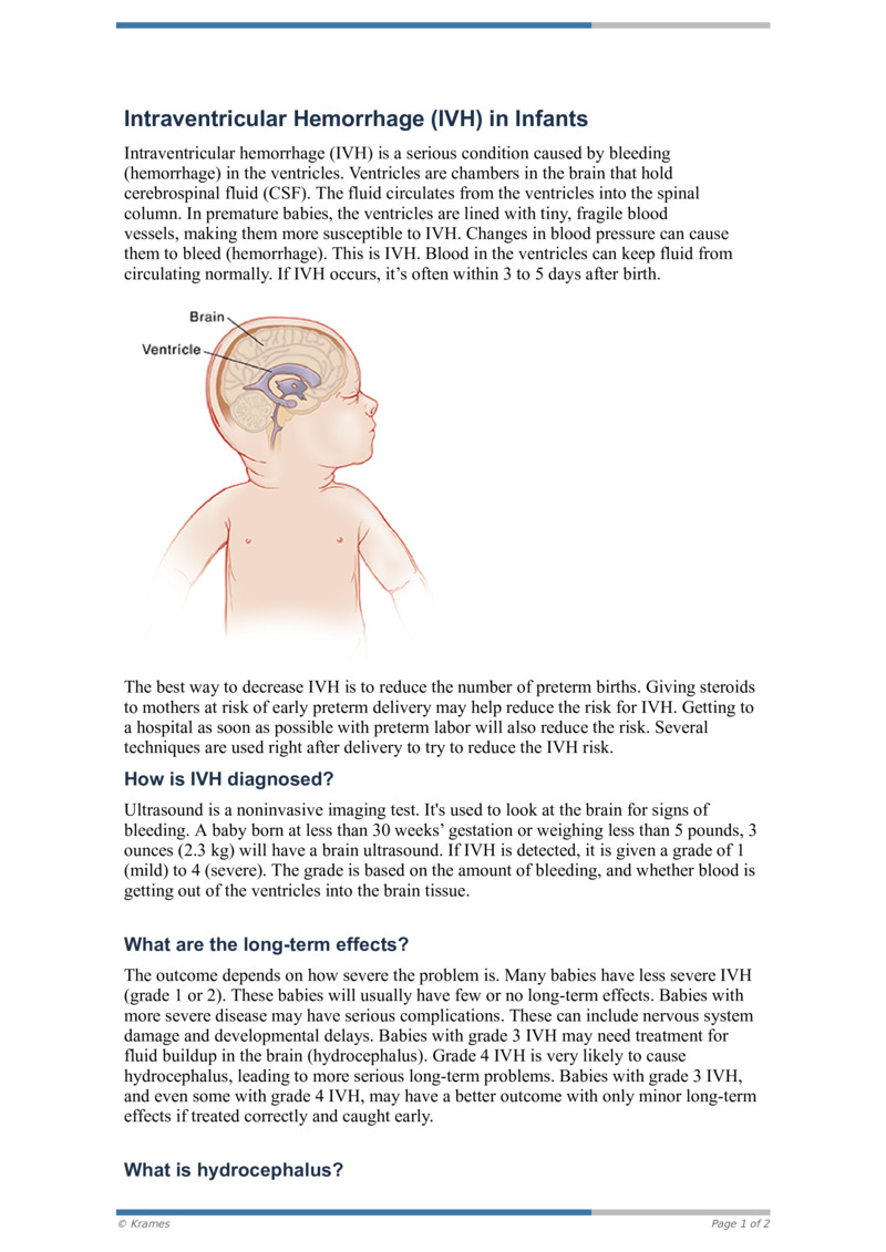 Pdf Intraventricular Hemorrhage Ivh In Infants Healthclips Online