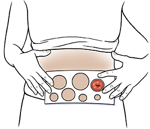 Colostomy Measuring Guide Text - Colostomy: Selecting Your Pouch - HealthClips Online