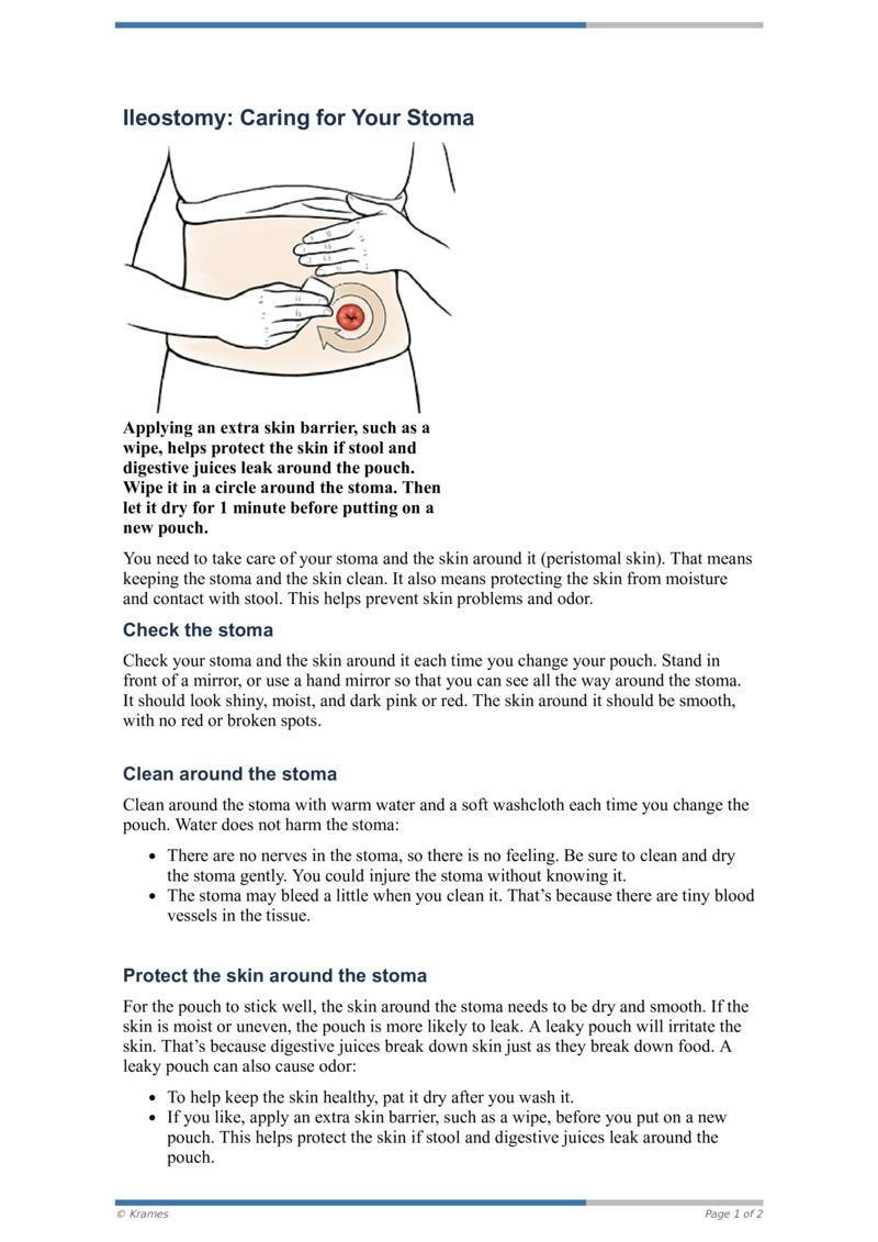 PDF - Ileostomy: Caring For Your Stoma - HealthClips Online