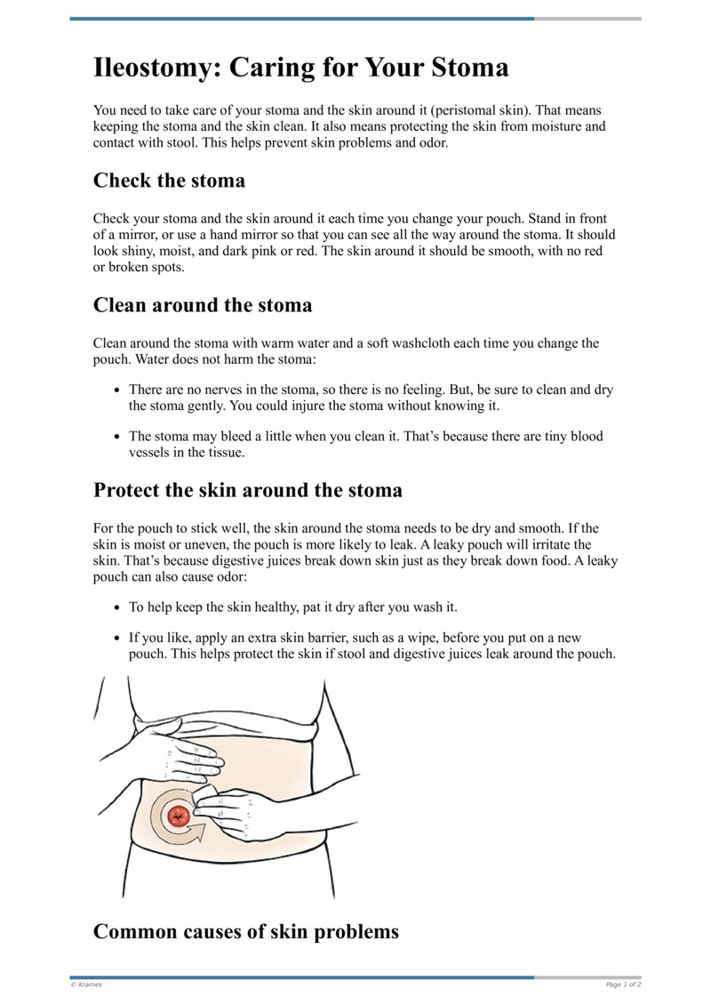 Text - Ileostomy: Caring For Your Stoma - HealthClips Online