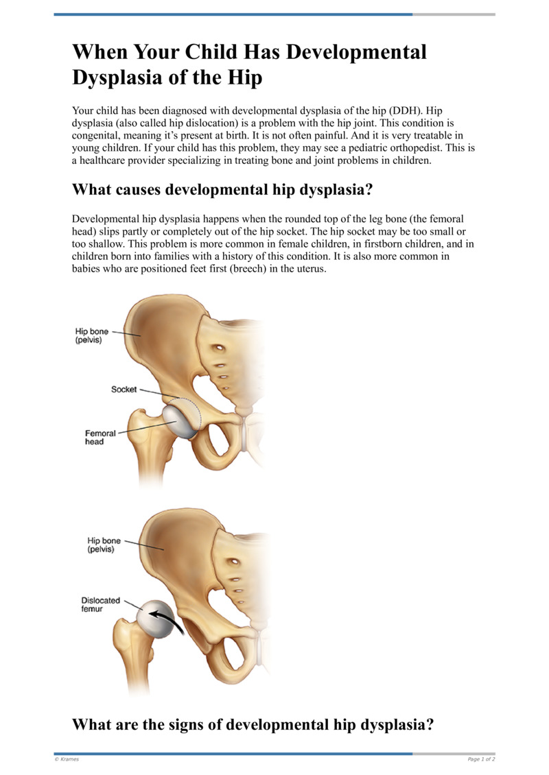 When Your Child Has Leg-Length Discrepancy (LLD)