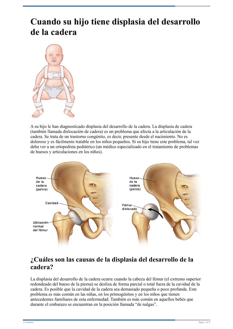 Text Cuando Su Hijo Tiene Displasia Del Desarrollo De La Cadera Healthclips Online 