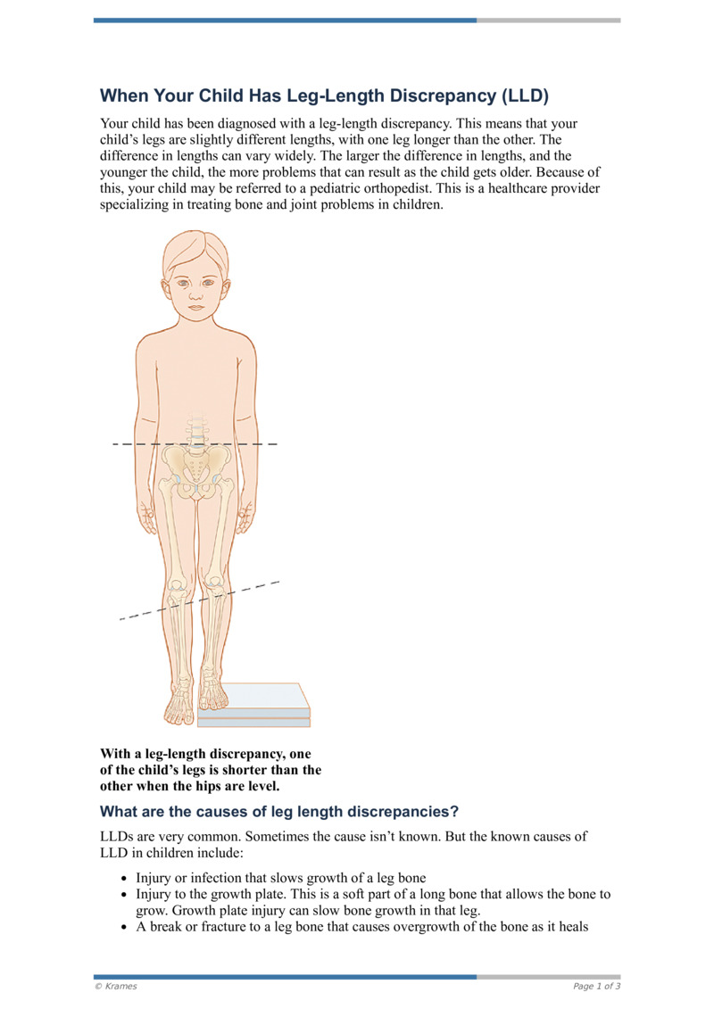 PDF When Your Child Has LegLength Discrepancy (LLD) HealthClips Online