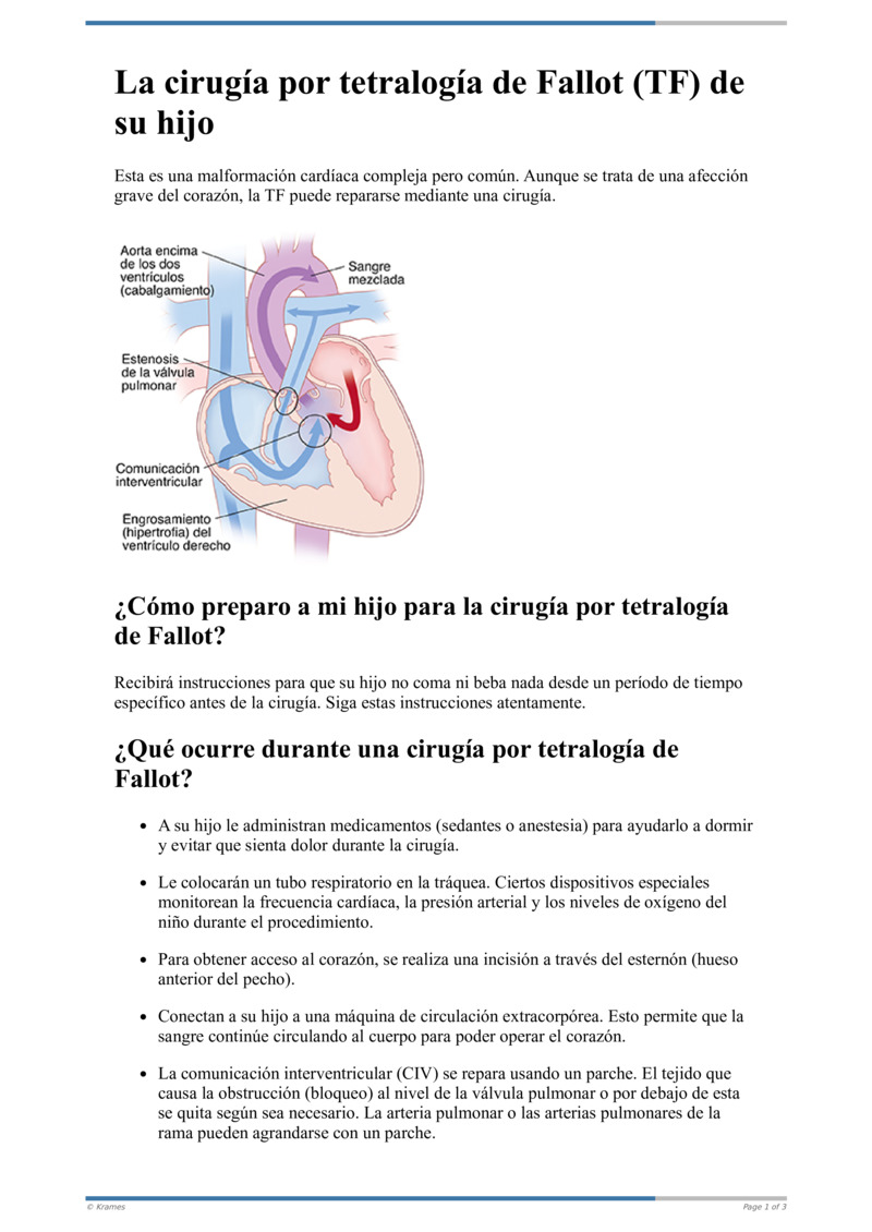 Text - La cirugía por tetralogía de Fallot (TF) de su hijo ...
