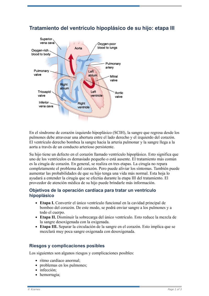 PDF Tratamiento del ventrí culo hipoplá sico de su hijo etapa III